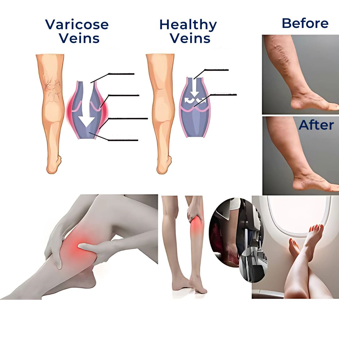 CircuEase Compression Socks | Soft, Highly Elastic Design for Muscle Recovery &amp; Circulation Enhancement for Professionals on Their Feet