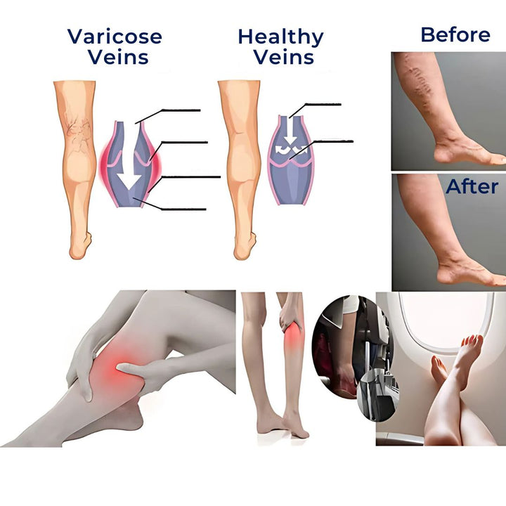 CircuEase Compression Socks | Soft, Highly Elastic Design for Muscle Recovery &amp; Circulation Enhancement for Professionals on Their Feet