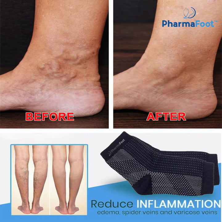 Neuropathy Therapy Socks